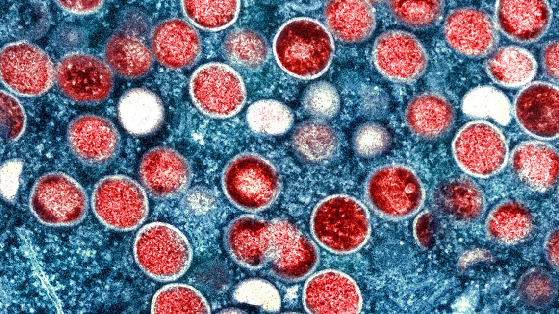 NIH researchers charged with attempting to smuggle vials of mpox virus into the US