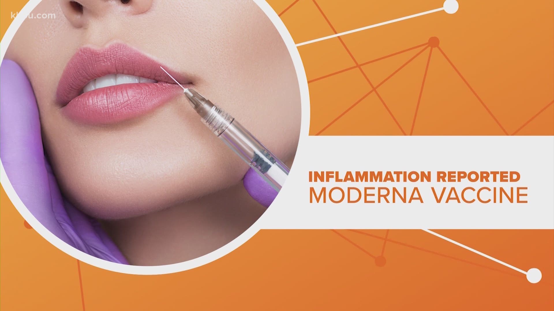 The FDA has a warning about an unusual side effect for the Moderna coronavirus vaccine for patients with cosmetic facial fillers. Let’s connect the dots.
