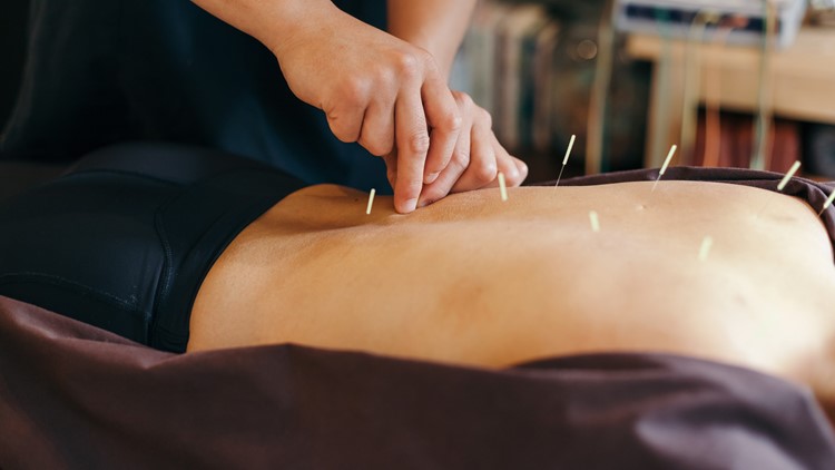 The New You: The stress and pain relieving power of acupuncture