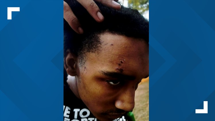 Memphian says he was beaten by Memphis Police's SCORPION Unit 3 days before Tyre Nichols died