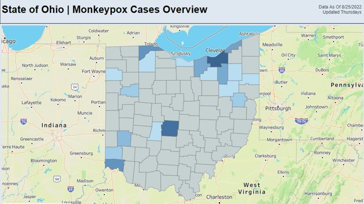 Ohio Department of Health launches monkeypox dashboard as Cuyahoga County cases rise