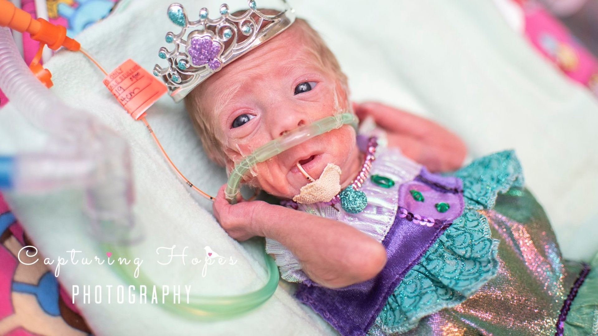 Charlotte preemies celebrate first Halloween in costumes