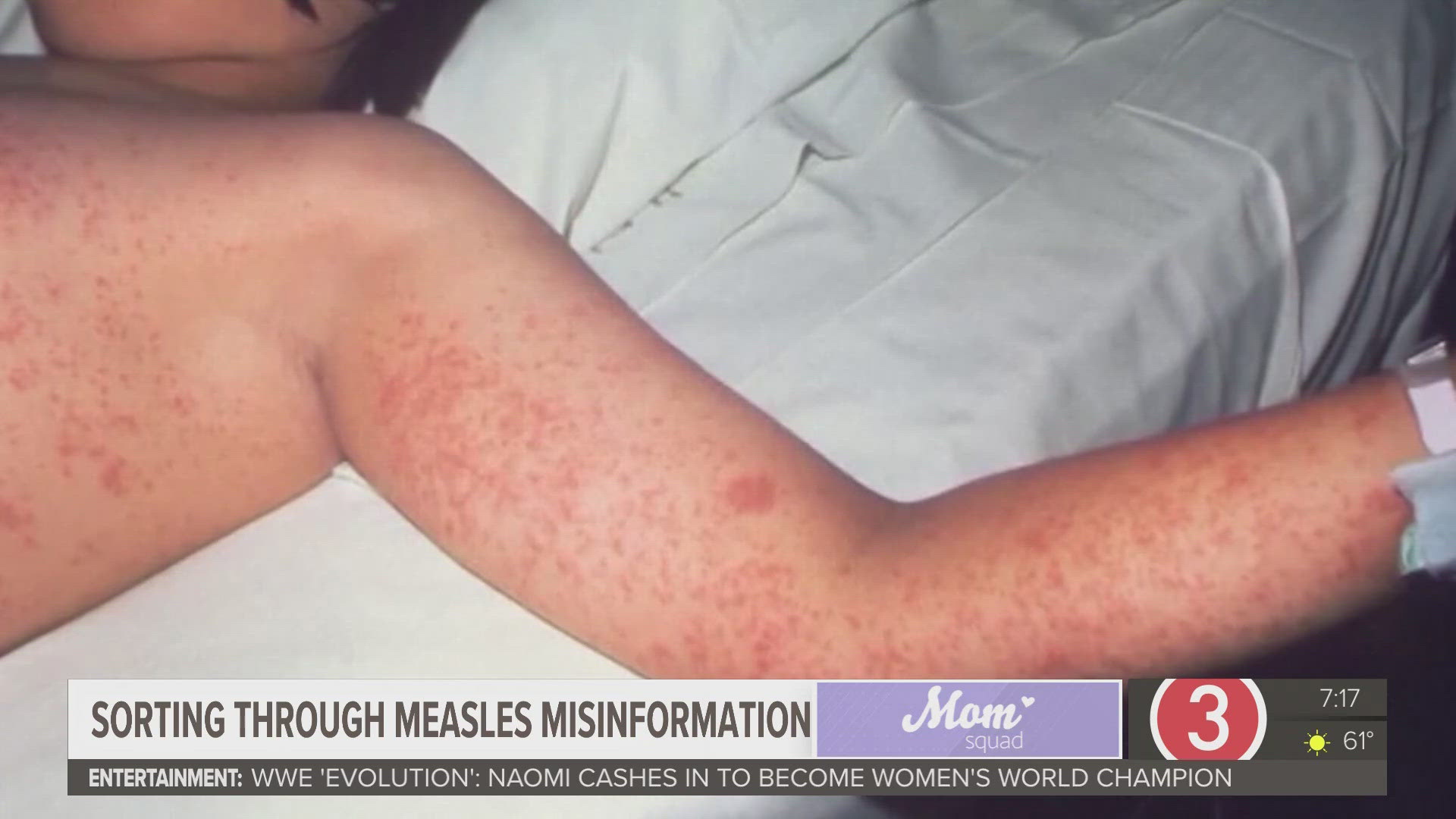 3News’ Senior Health Correspondent Monica Robins talked to Kristin Englund, an infectious disease specialist with Cleveland Clinic about measles and misinformation.