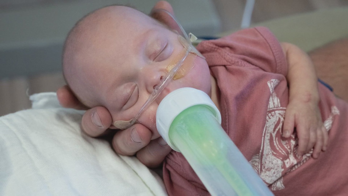 'He is a champ': Akron Children’s Hospital sends home preemie born at 22 weeks