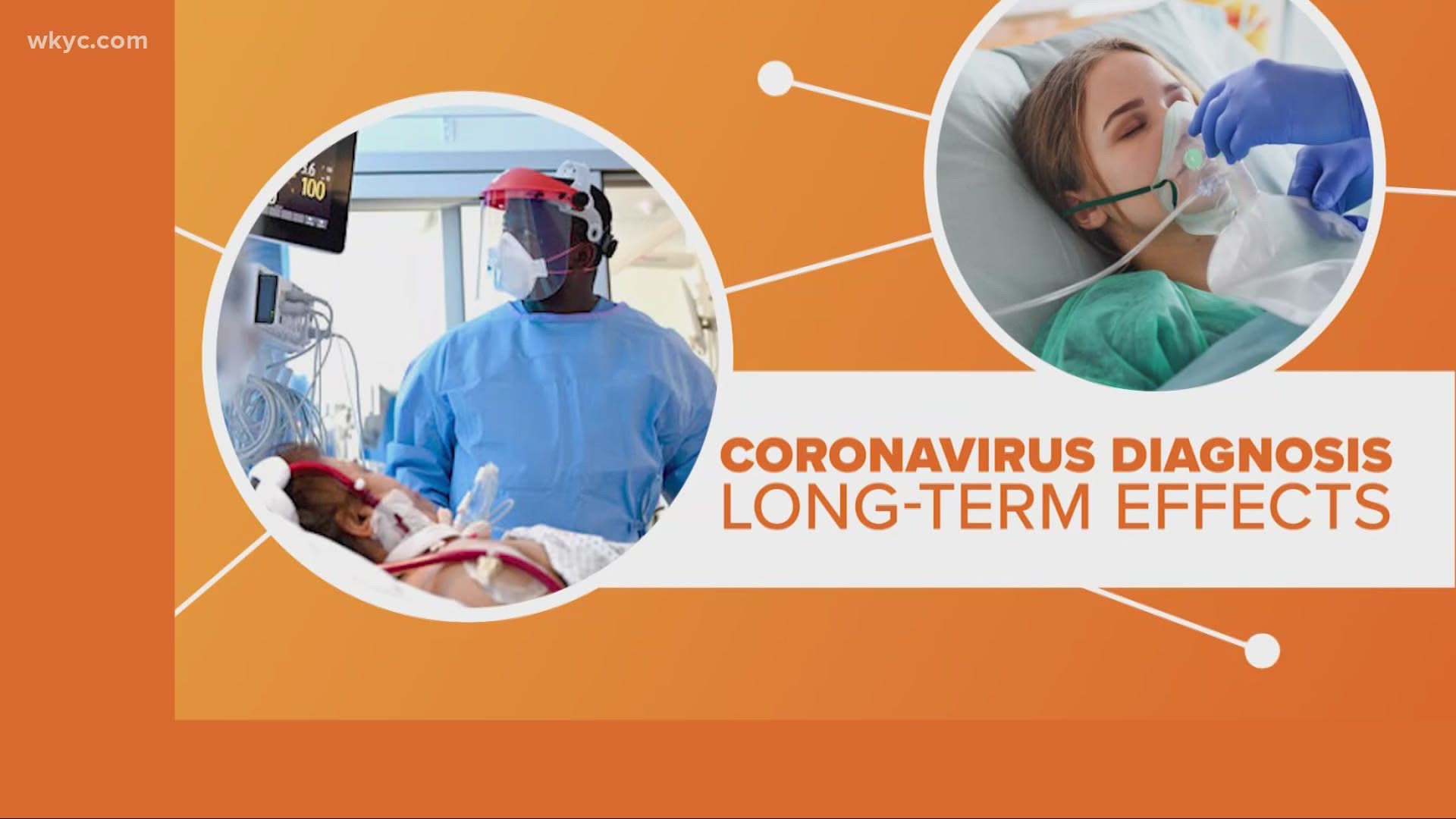 Here's what experts are saying about the long-term health effects of COVID-19 as we learn more about the coronavirus.