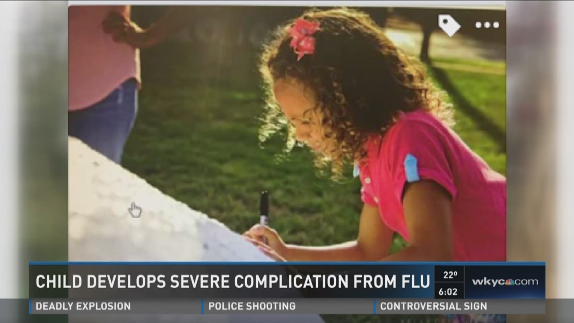 Child develops severe complication from flu