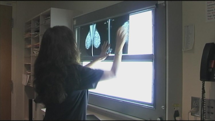 What age should you get your first mammogram? Cleveland Clinic gives advice