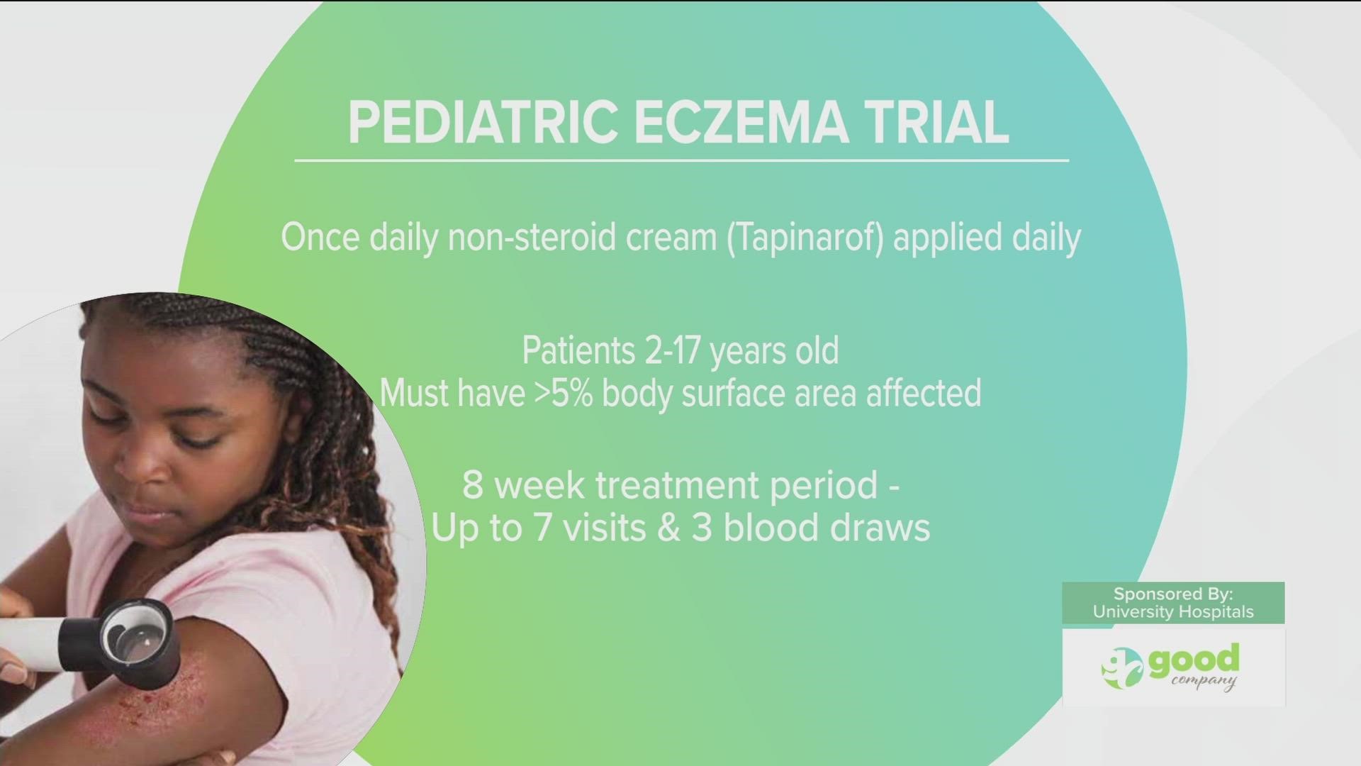 Joe talks with Dr. Neil Korman about the new clinical trial taking place for pediatric patients with eczema. Sponsored by: University Hospitals