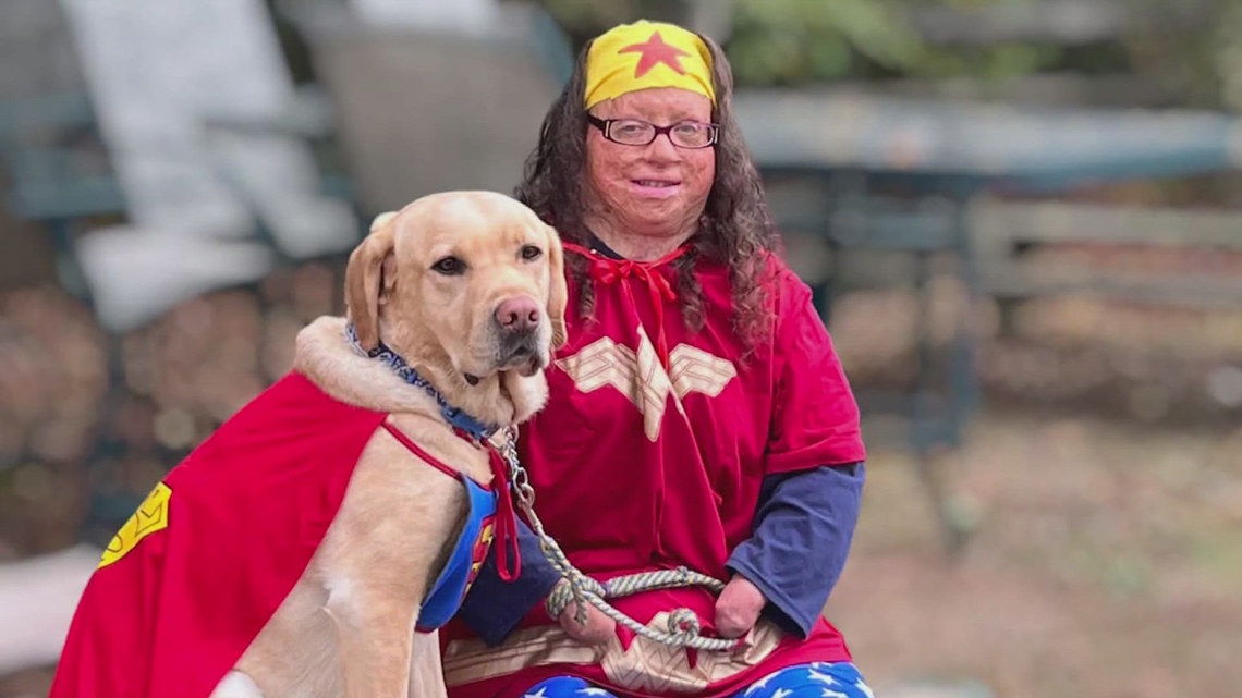 'I wouldn't have it any other way, because I'm here': Parma Heights woman who survived devastating house fire finds purpose in horses, service dogs