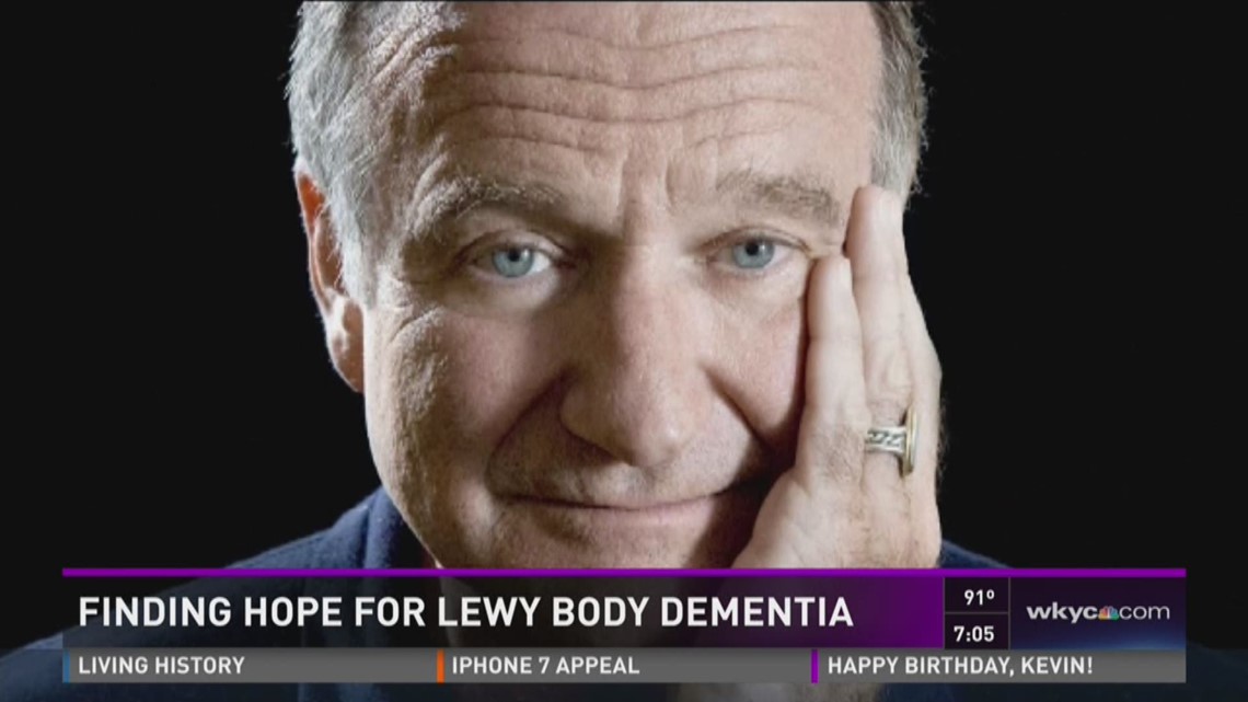 Cleveland Clinic Study On Lewy Body Dementia | Wkyc.com