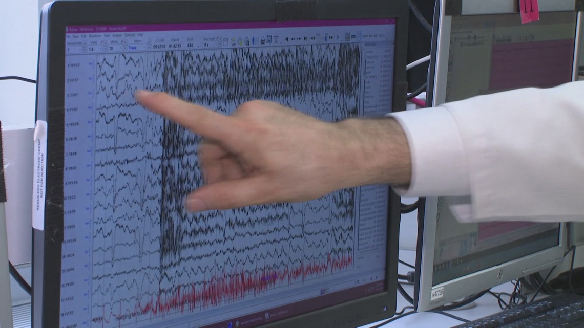 Cleveland Clinic teaching artificial intelligence to read brain waves and detect seizures in seconds