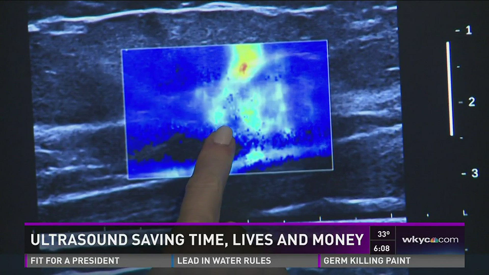 High Tech Ultrasound saves time, lives and money | wkyc.com