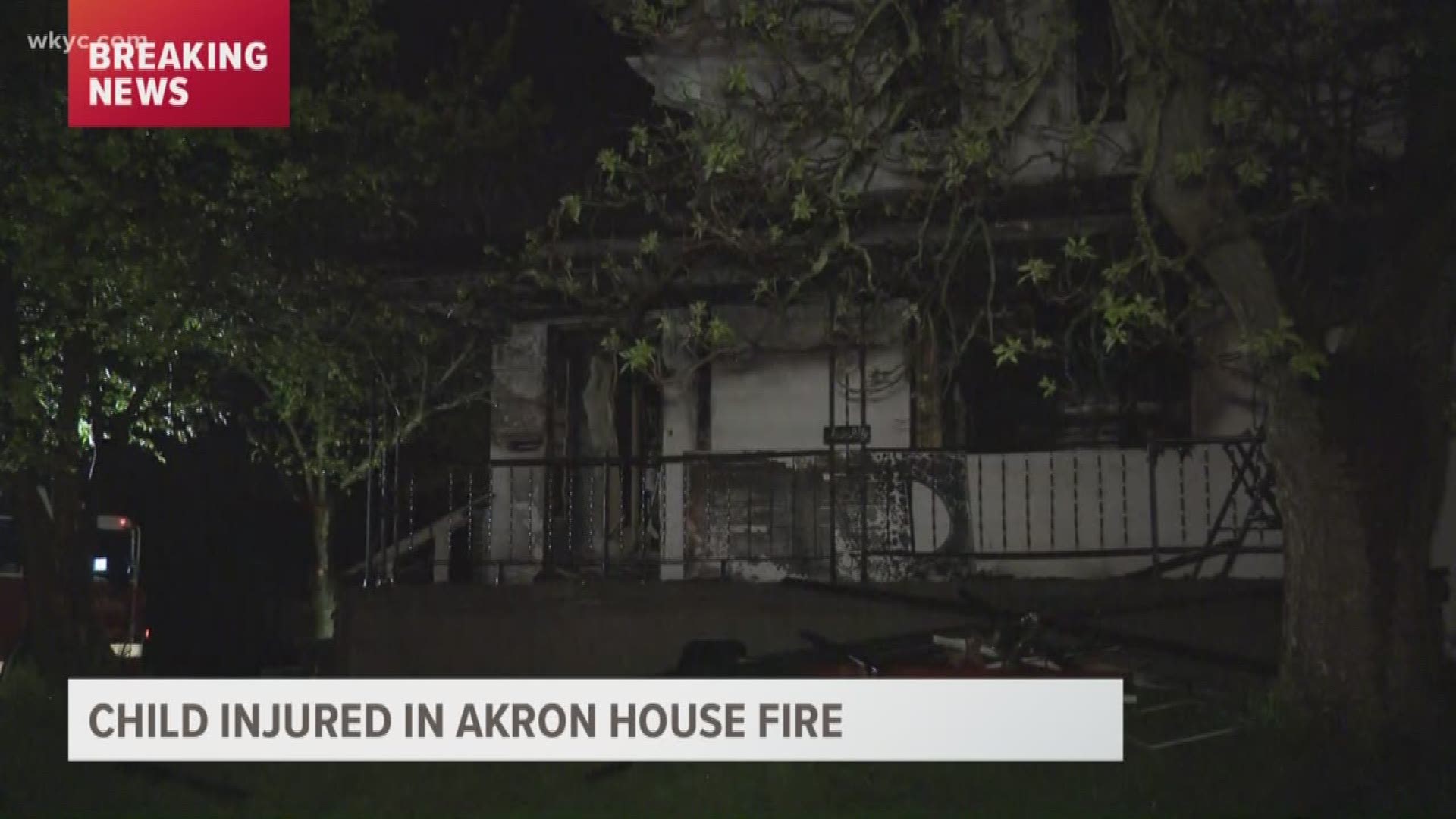 Akron house fire sends one child to the hospital