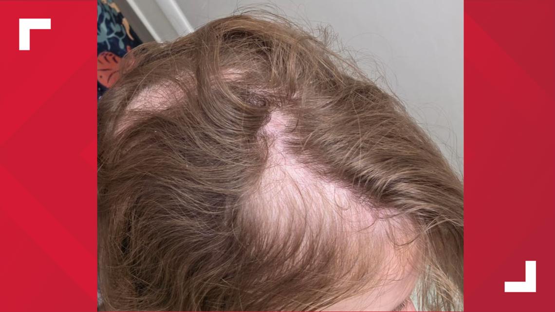 Cleveland EMS: Paramedics assaulted while helping patient Curated by Alerts360