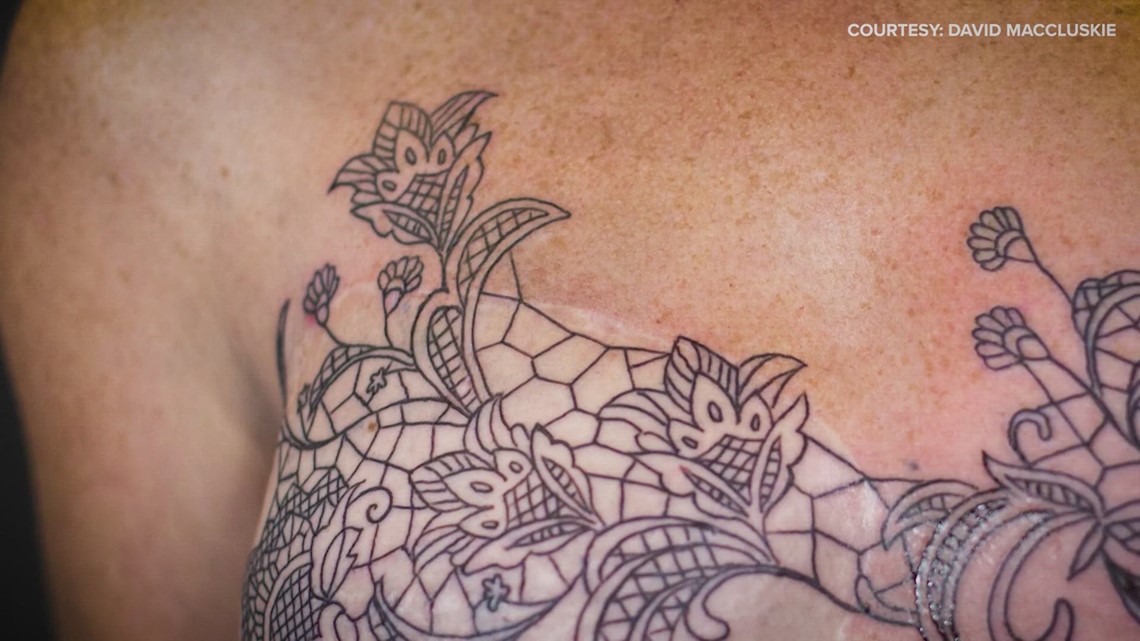 Photos Show How Breast-Cancer Survivor Turned Scars Into Tattoos