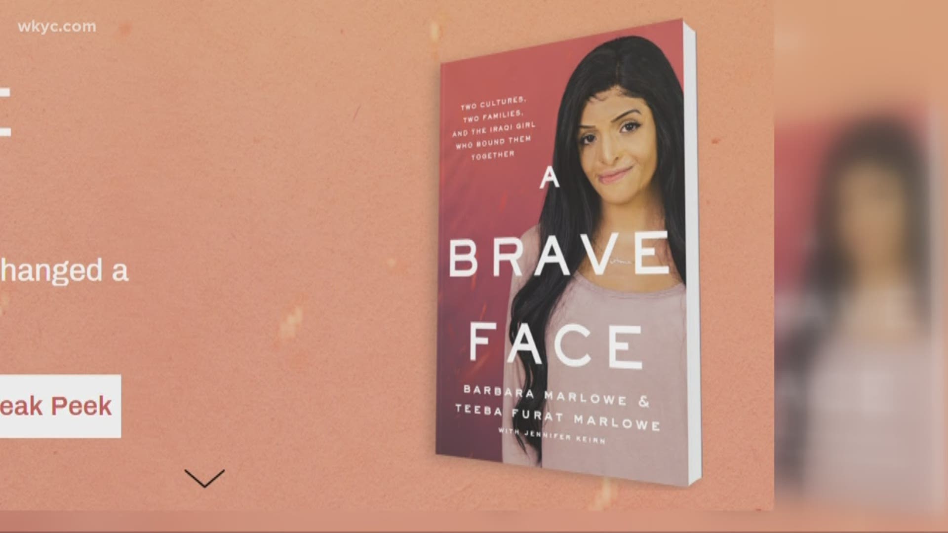Life story of disfigured Iraq girl now living in Concord is now a book