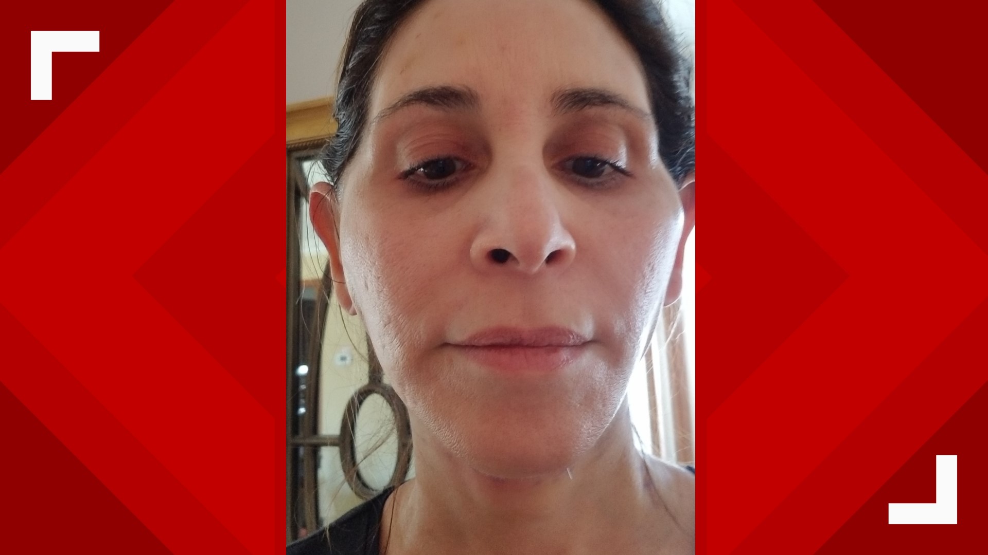 Before and after See photos of our 'Live in the OR' patient after