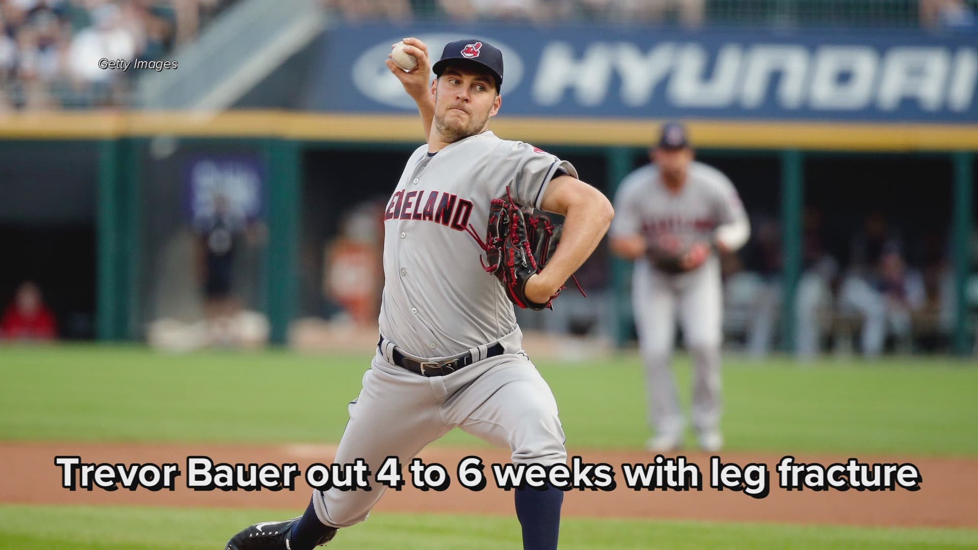 Cleveland Indians' Trevor Bauer out 4 to 6 weeks with leg fracture