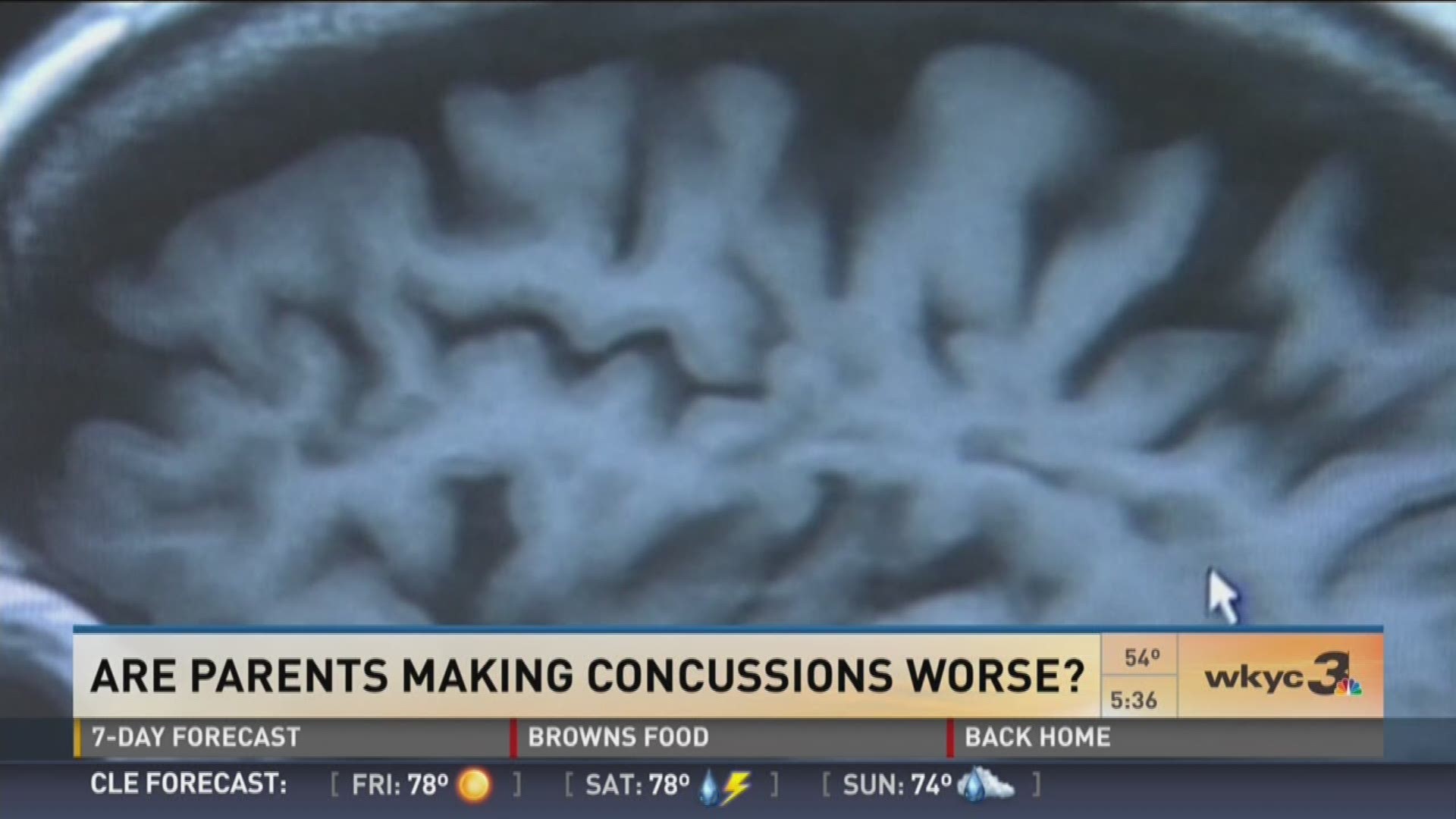 Are parents making concussions worse?: Will Ujek