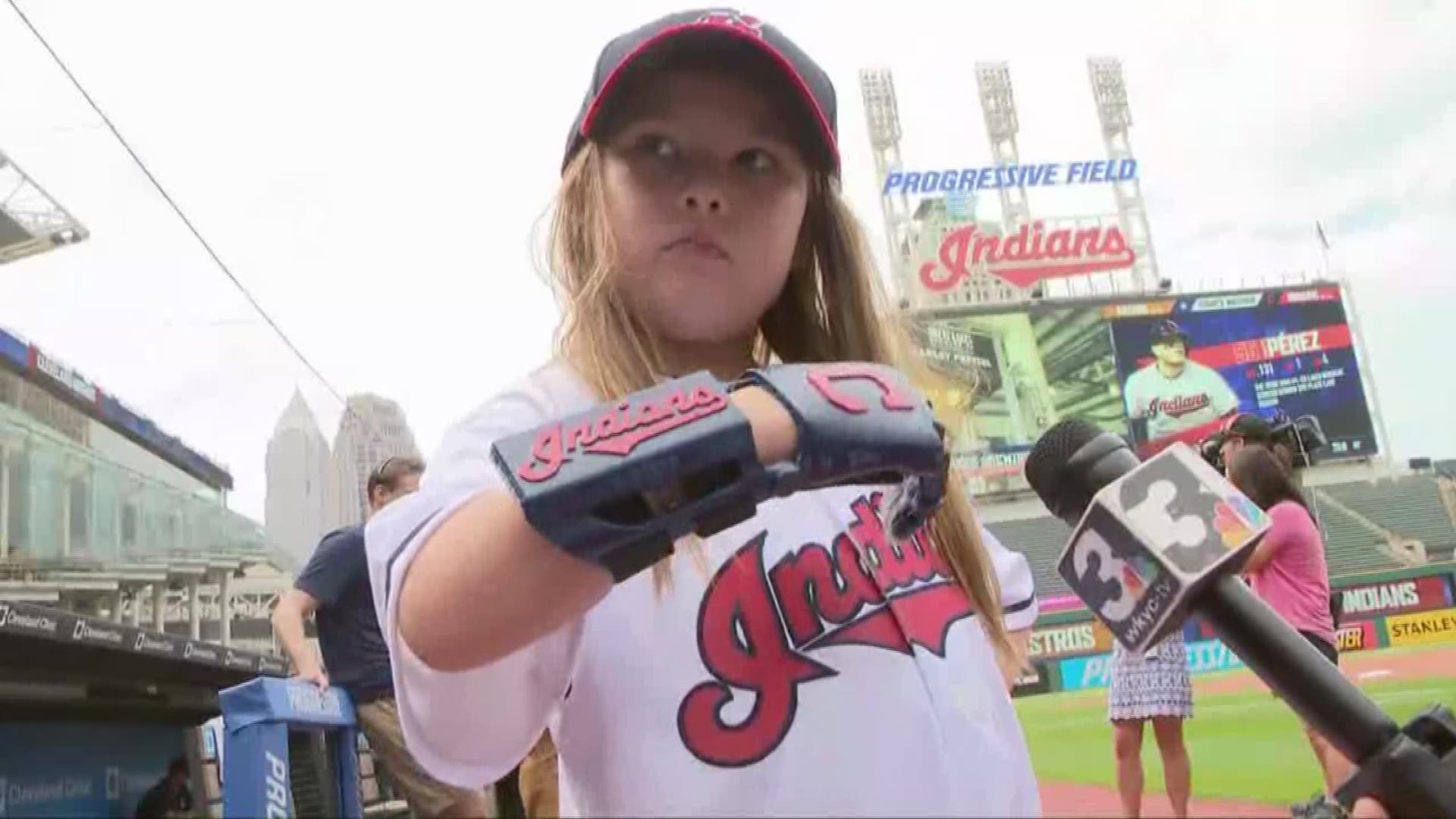 Girl with 3-D printed right hand to throw out first pitch at Indians game
