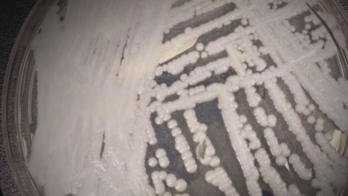 Cleveland Clinic reacts to CDC report about deadly fungus spread