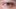 Is COVID causing pink eye?