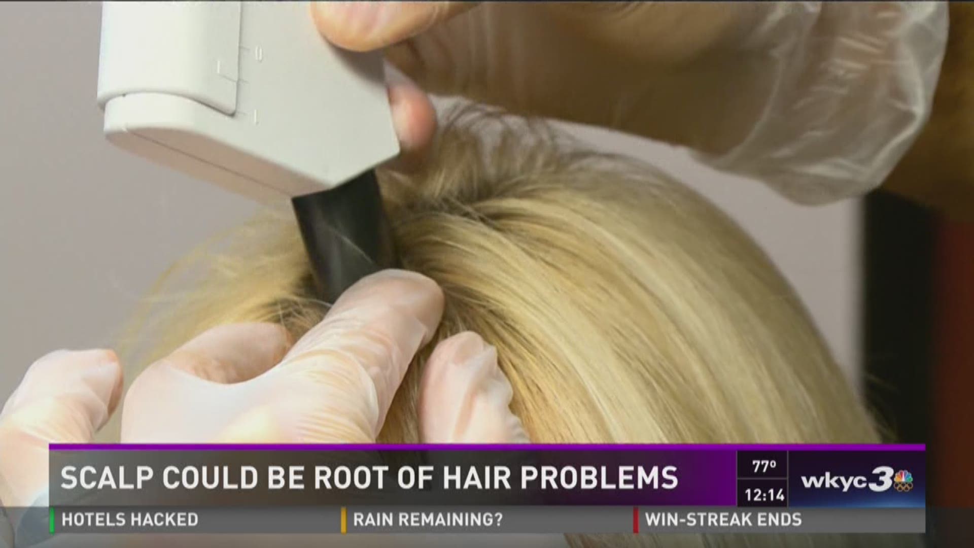 Trichology: Scalp may be root of hair problems 