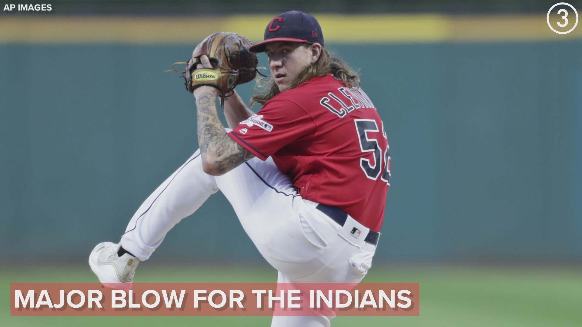 Say it isn't so!  Cleveland Indians pitcher Mike Clevinger will undergo surgery to repair a partial tear of the medial meniscus.