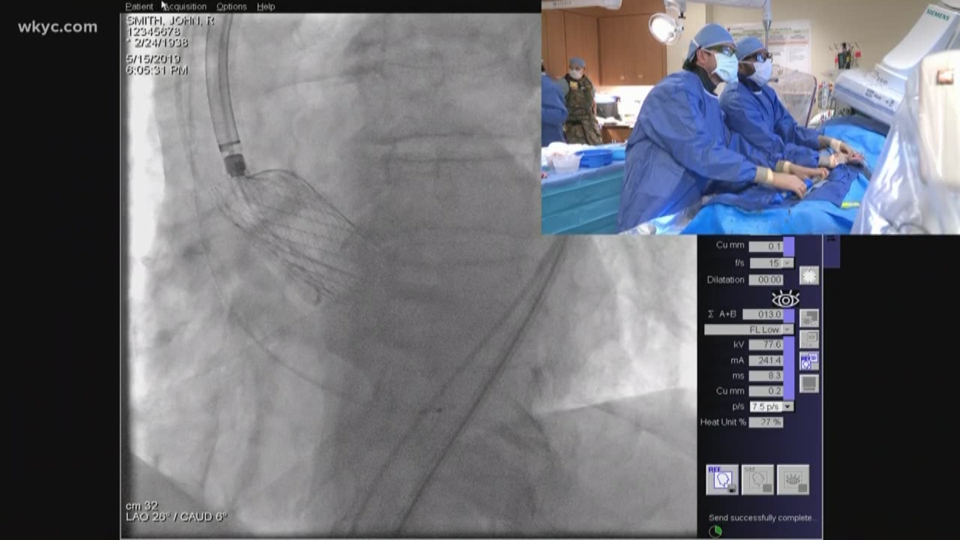WKYC.com streams live TAVR heart surgery