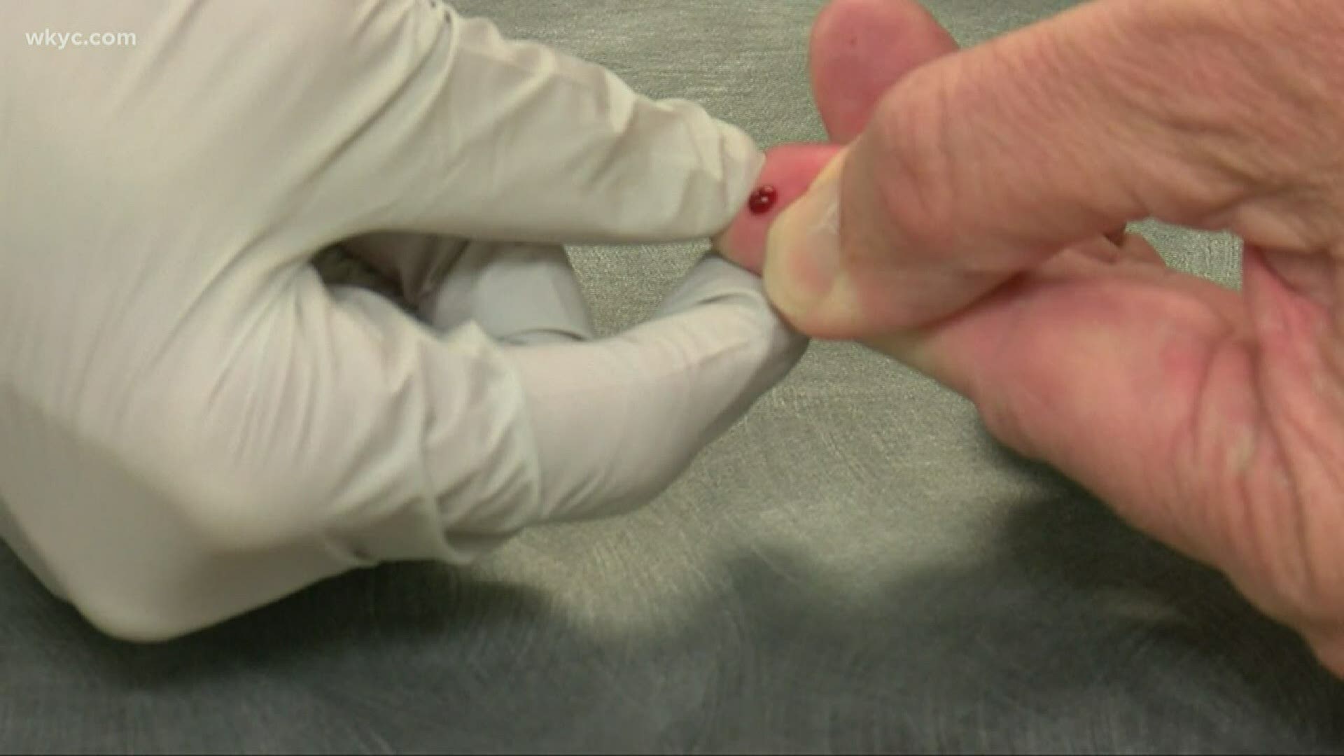 Officials say testing could help indicate the reach of the disease. Lynna Lai reports.