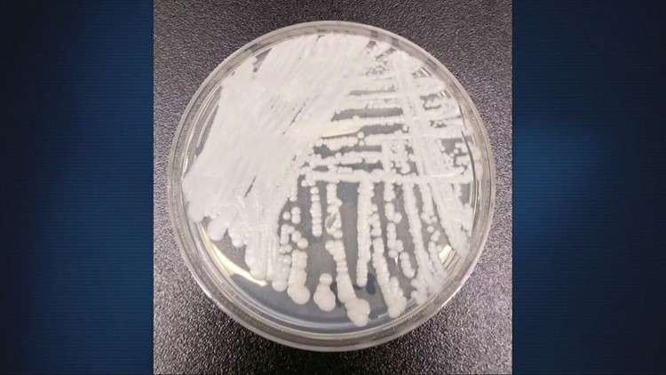 CDC says dangerous fungus spreading; Cleveland Clinic specialist provides guidance