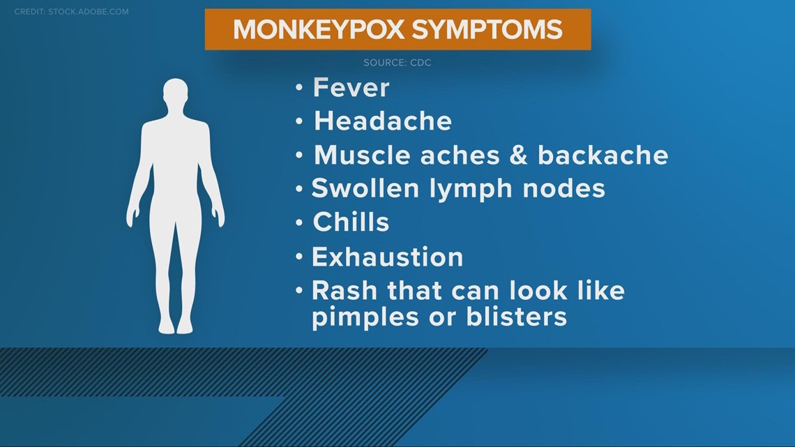 Monkeypox cases tick upward in Ohio as local COVID-19 cases decline