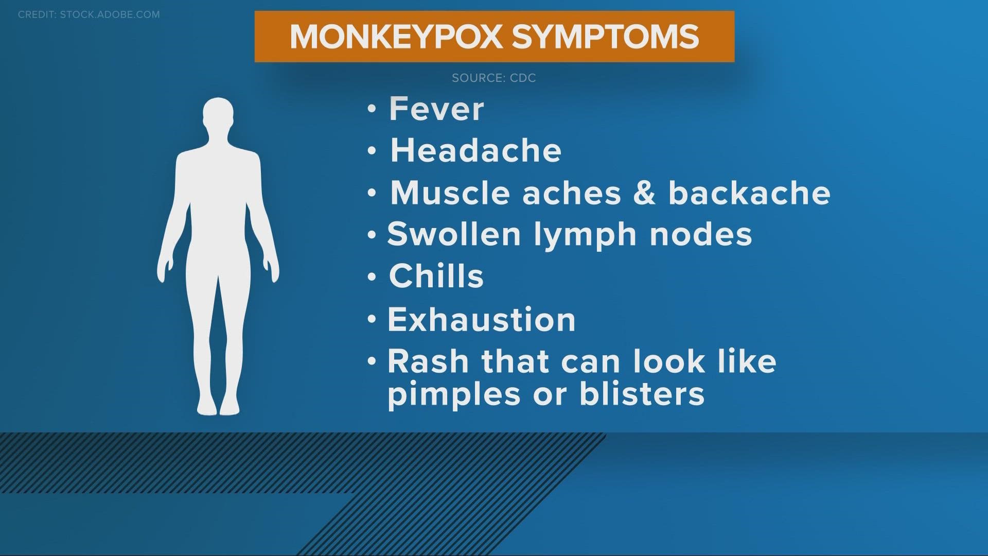 As COVID-19 cases decline across Northeast Ohio, a new public health concern has emerged in Monkeypox. 3News Health Correspondent Monica Robins reports.
