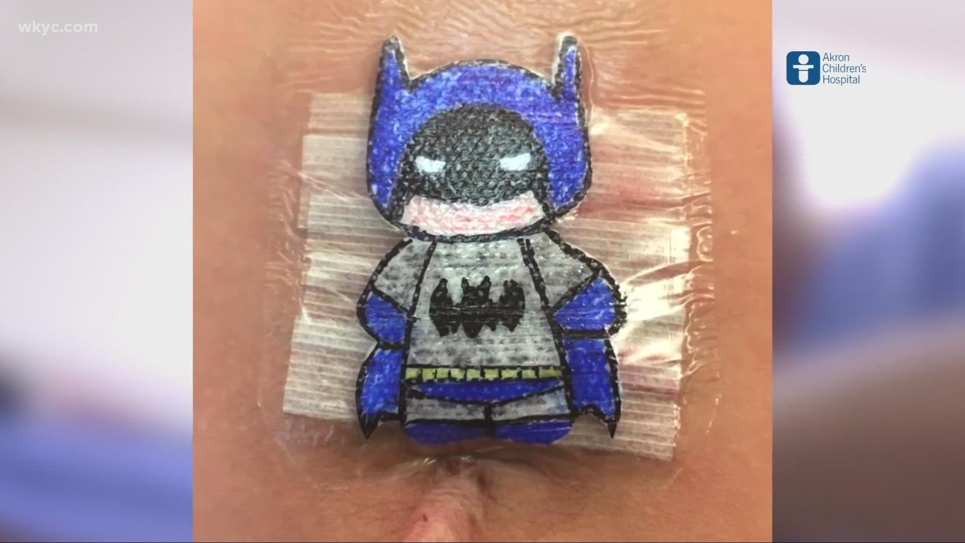 Dr. Bob Parry hand draws colorful characters and turns them into custom bandages to help ease fears of children going through surgery.