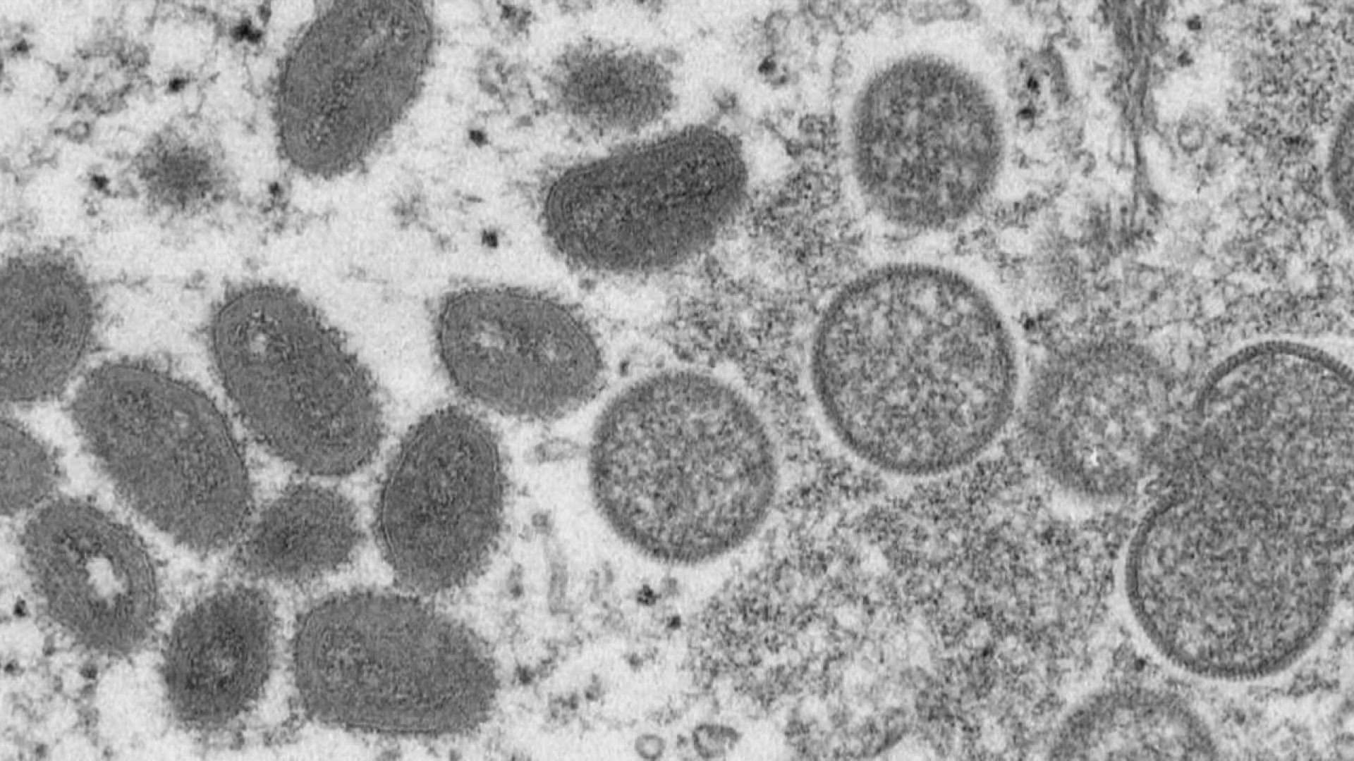 The U.S. Department of Health and Human Services announced Tuesday that it would enhance the "nationwide strategy to mitigate the spread of monkeypox."