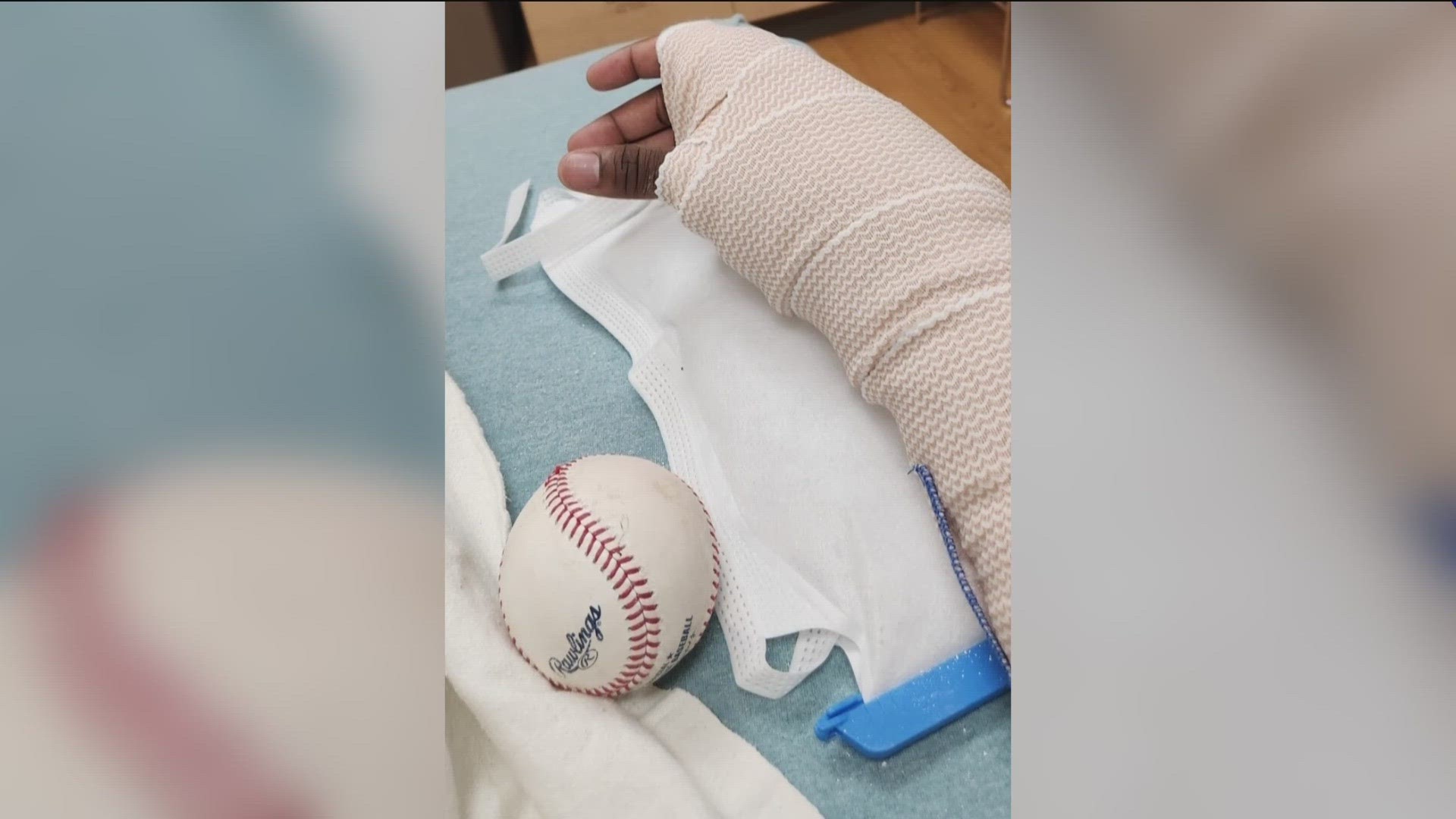 can-a-baseball-break-your-hand-if-you-catch-it-without-a-glove-wkyc