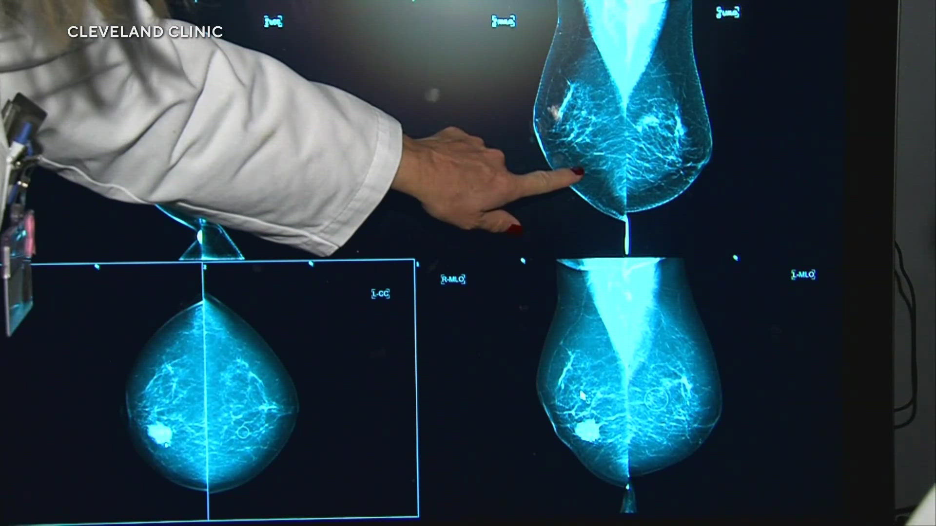 WUSA9 spoke with Lucy De La Cruz, MD at MedStar Georgetown University Hospital, who provided relevant recommendations for women.