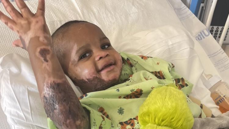 Powder Springs baby burned in freak accident returns home